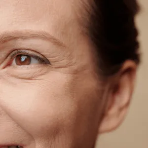 Remove your fine lines and facial wrinkles with Pico Lasers at Da Vinci Skin & Aesthetic Clinic Malaysia