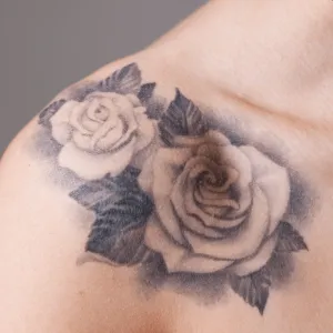 Tattoo removal of any size with Pico laser at Da Vinci Skin & Aesthetic Clinic Malaysia