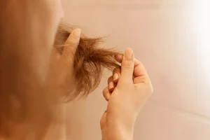 hair treatment for hair loss in kuala lumpur