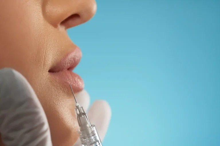 best derma fillers treatment in kuala lumpur