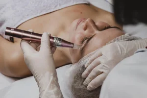 best microneedling treatment in kuala lumpur