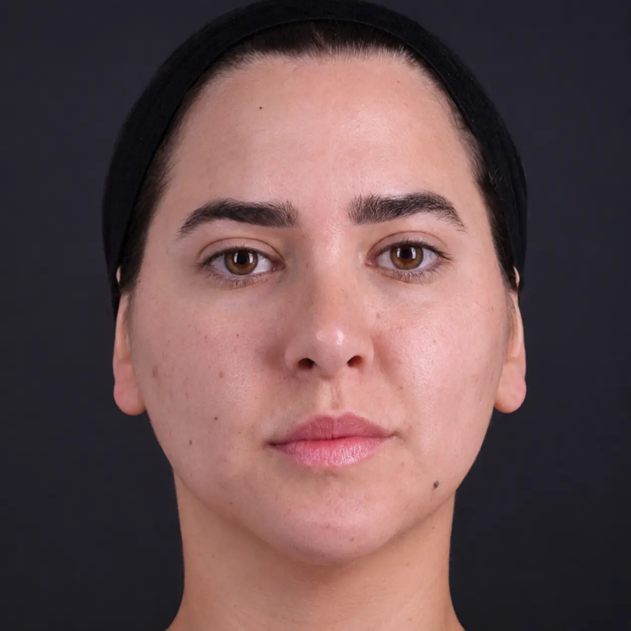 Brow position and upper face