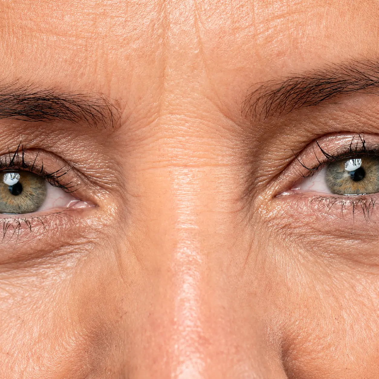 Fine lines and wrinkles
